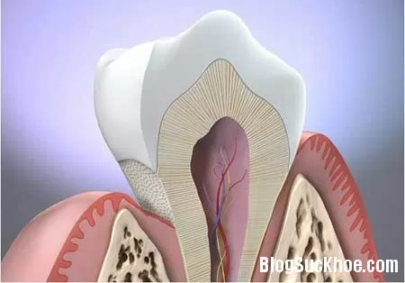 Nguyên nhân gây viêm nướu răng ở trẻ