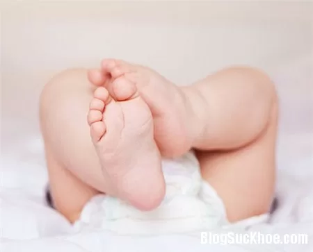 Trẻ bị bội nhiễm, sốt cao do hăm tã