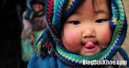5 cách trị nẻ cho bé ''má cà chua''