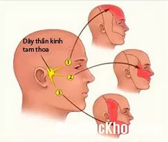 Đau nửa mặt, bệnh dễ nhầm với các chứng bệnh khác