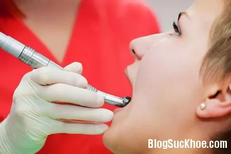 Triệu chứng điển hình của bệnh ung thư lưỡi