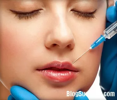 Những điều cần chuẩn bị trước khi ''dao kéo''