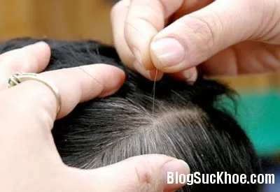Chữa tóc bạc sớm nhờ chế độ ăn uống