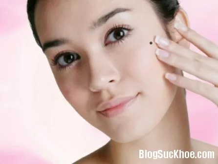 Mẹo tẩy nốt ruồi tại nhà nhờ thiên nhiên