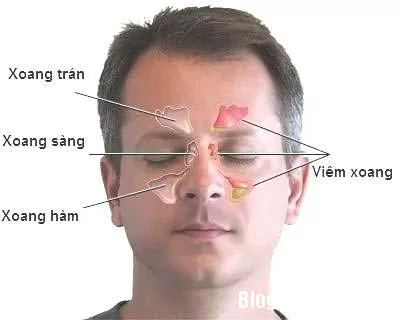Một số thuốc thường dùng trong bệnh viêm mũi xoang