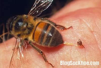 Cách xử lý khi bị ong đốt