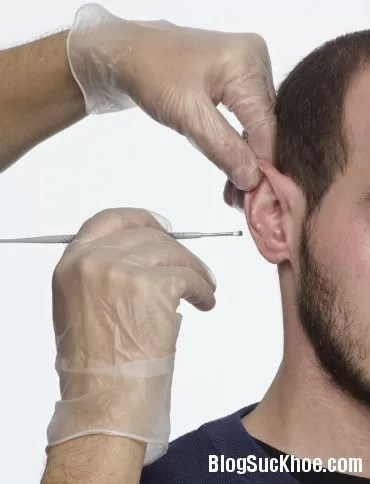 Các bước vệ sinh tai an toàn