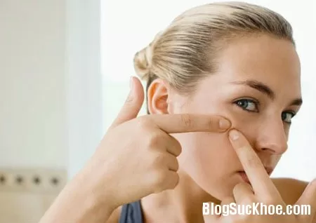 Những thực phẩm ăn nhiều gây mụn cho da