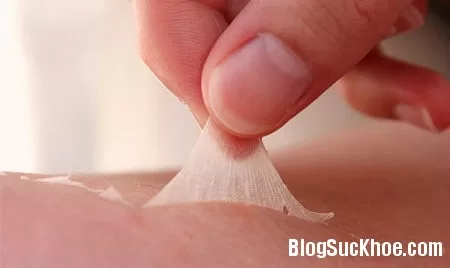 Những cách đơn giản trị da bị cháy nắng