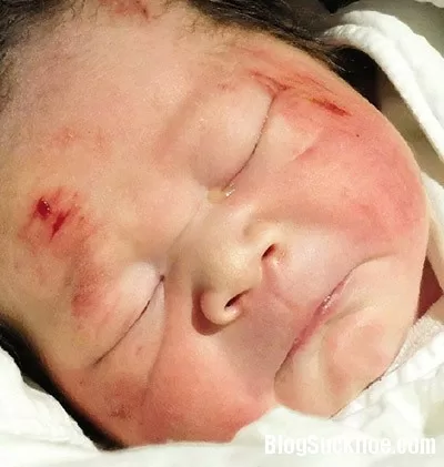 Đắng lòng mẹ cố sinh con trước khi qua đời do tai nạn