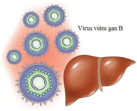 Viêm gan B và ung thư gan