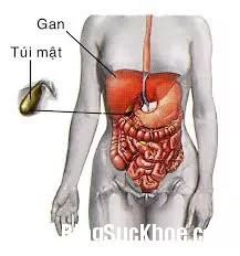 Sỏi mật hình thành như thế nào?