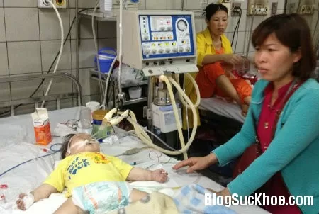 Người lớn không nên chủ quan với dịch sởi