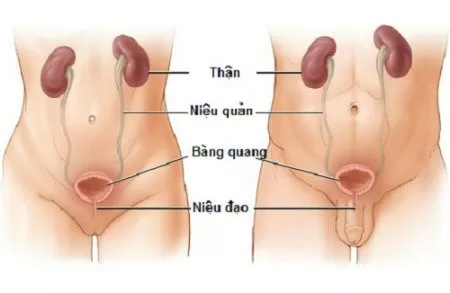 7 cách phòng chống viêm nhiễm đường tiết niệu