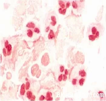 Nhiễm C. trachomatis đường sinh dục tiết niệu