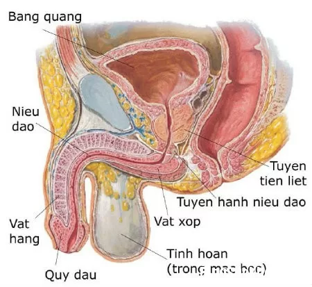 Viêm tiền liệt tuyến cấp tính