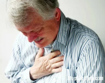 Những triệu chứng đột quỵ bạn không nên chủ quan