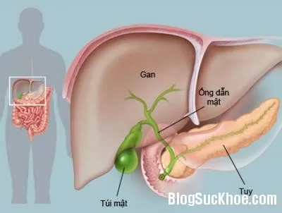 Viêm tụy cấp do tăng mỡ máu