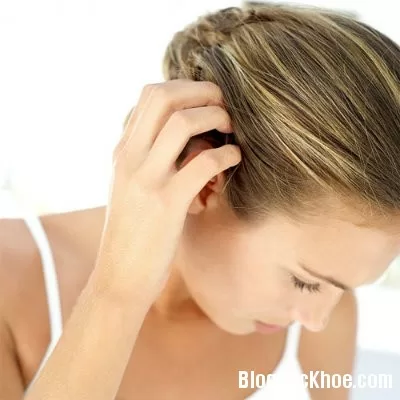 Phương pháp trị gàu từ tự nhiên
