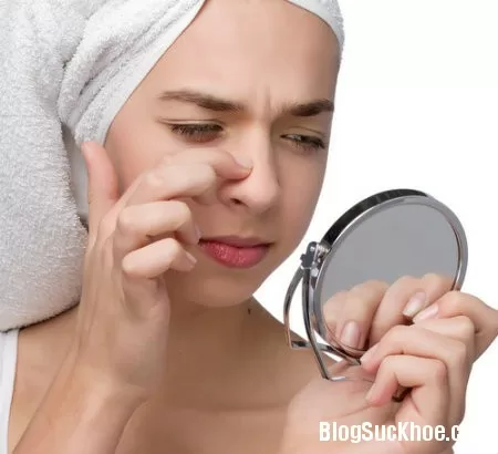Cách trị mụn đầu đen ở mũi đơn giản mà hiệu quả