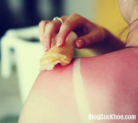 Phân biệt các vấn đề thường gặp mùa nắng nóng