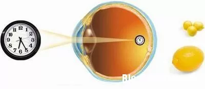 Bệnh glôcôm, phát hiện sớm tránh mù lòa