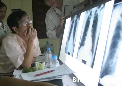 Dấu hiệu nhận biết bệnh bụi phổi