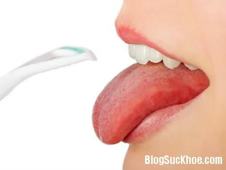 Nguyên nhân khiến lưỡi bị vàng