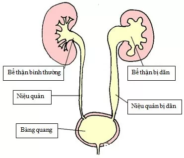 than