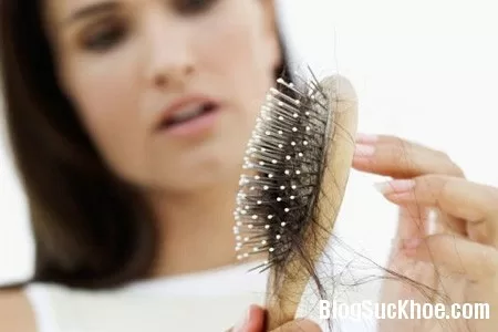 Bệnh nấm tóc