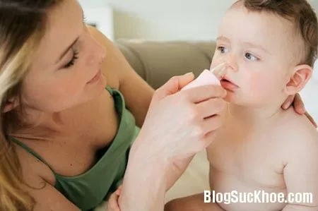 Mẹo điều trị ngạt mũi cho bé