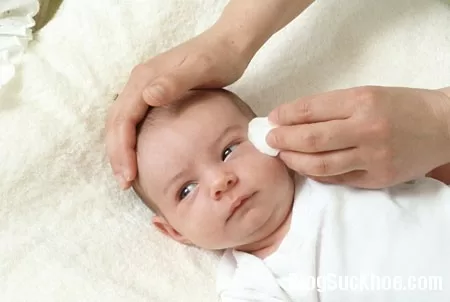 Bệnh viêm mí mắt ở trẻ nhỏ