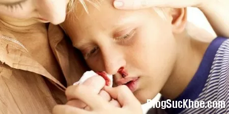 Cách cầm máu khi bị chảy máu cam