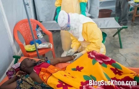 Triệu chứng của bệnh sốt xuất huyết Ebola