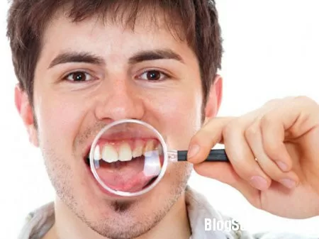 Những vấn đề răng miệng thường gặp