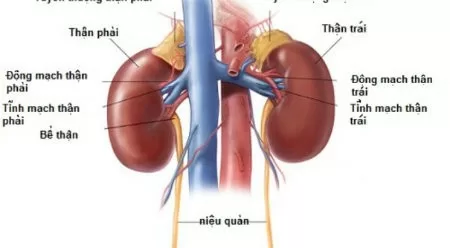 Bệnh viêm cầu thận cấp