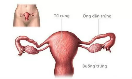 Những vấn đề cần quan tâm khi triệt sản ở nữ: cách làm, rủi ro và ai dễ hối tiếc