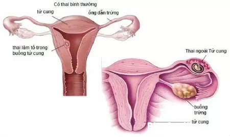 tu cung1