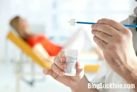 Các giai đoạn phát triển của ung thư cổ tử cung