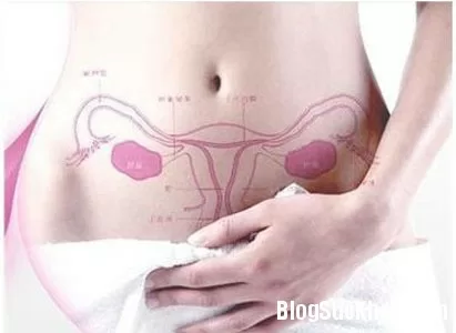4 giai đoạn phát triển của ung thư cổ tử cung