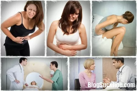 3 loại u nang buồng trứng không thể xem thường