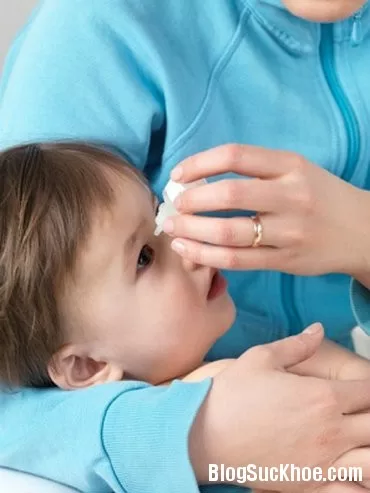 5 điều mẹ cần làm khi bé bị đau mắt đỏ