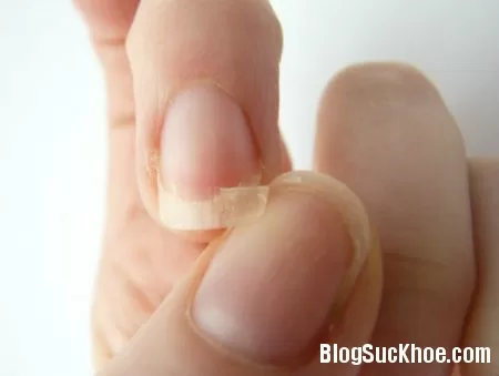 Dấu hiệu trên móng tay liên quan đến sức khỏe