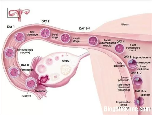 Tắc ống dẫn trứng (vòi trứng) gây vô sinh: nguyên nhân, cách phát hiện và cơ hội có con
