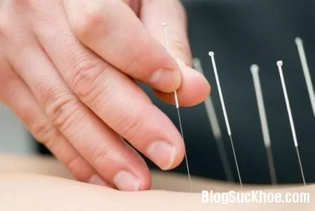 Chữa bệnh thoát vị đĩa đệm