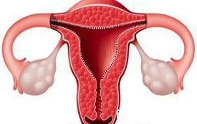 Những vấn đề bất thường ở tử cung