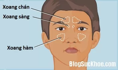 Dấu hiệu nhận biết trẻ bị viêm xoang