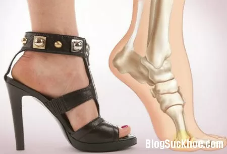 Tác hại khi mang giày dép không phù hợp và cách chọn đôi giày vừa chân