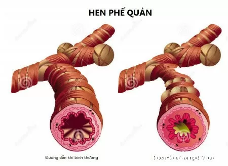 hen