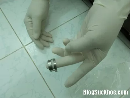 Nhớ đời vì nhét bi, đeo bông vào "súng ống"